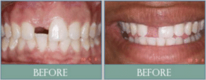 Smile results 14 Screen shot 2018 11 20 at 2. 03. 37 pm