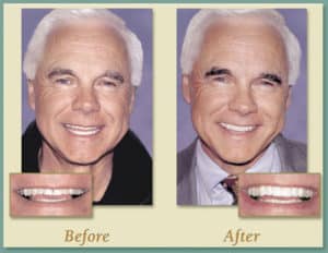 Smile results 16 Smile results