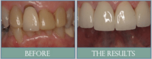 Smile results 10 Smile results