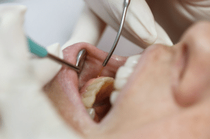 Diabetes and Gum Disease: What You Need to Know