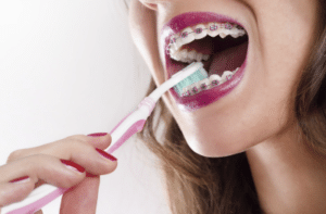 6 cleaning tips for braces 2 6 cleaning tips for braces