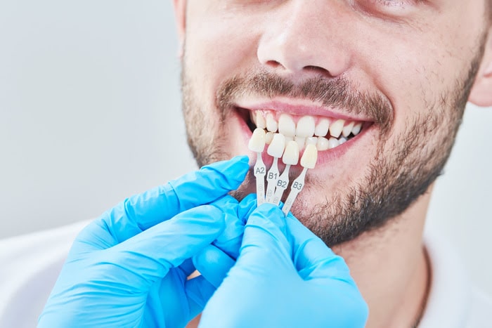 cosmetic dentistry teeth whitening Hooper dentistry