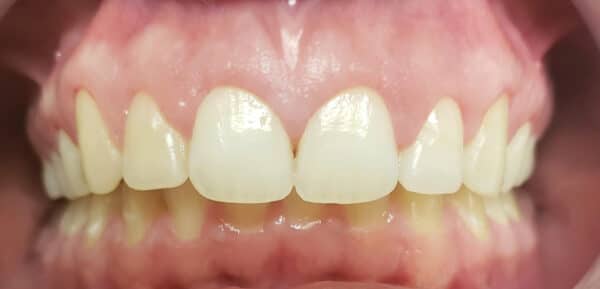 Hooper dentistry cosmetic 1 Hooper dentistry