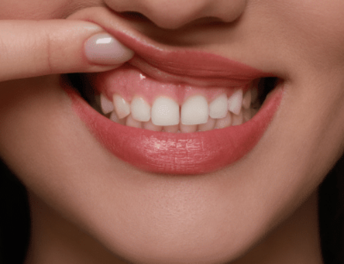 Foods That Promote Healthy Teeth and Gums